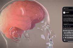 Neuralink 腦機接口設(shè)備獲 FDA“突破性設(shè)備”認(rèn)證，助力重度語言障礙患者恢復(fù)溝通能力
