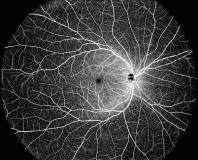 Intalight的先進DREAM OCT掃頻源成像技術獲得CE認證標志 
