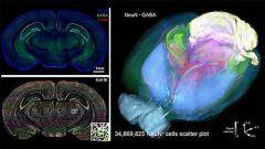 MATLAB 助力香港中文大學解決生物醫學圖像處理挑戰